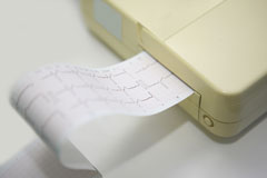 D�t�rioration pr�coce des bioproth�ses Mitroflow aortiques