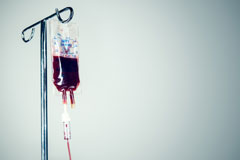 Les saignements sous anticoagulant des patients canc�reux sont associ�s aux m�tastases, l'�ge et l'existence de l�sions c�r�brales