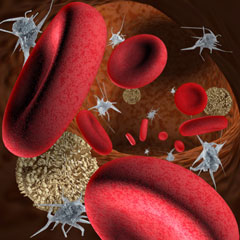 Relation entre ferritine et mortalit  partir des donnes de DOPPS