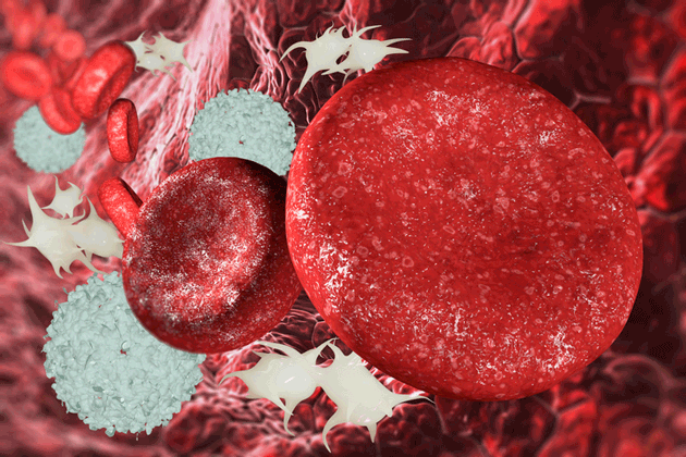 Les v�sicules extracellulaires induisent l'activation et l'agr�gation plaquettaire dans le cancer du sein de fa�on d�pendante et ind�pendante du facteur tissulaire