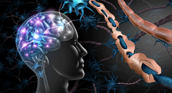 SEP&nbsp;: des troubles apparaissent jusqu'&agrave; 15 ans avant le d&eacute;but des sympt&ocirc;mes li&eacute;s &agrave; la d&eacute;my&eacute;linisation