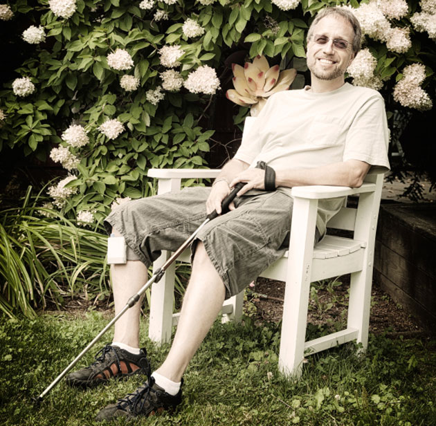 Le secukinumab&nbsp;: une option th�rapeutique chez les patients psoriasiques atteints de scl�rose en plaques n�cessitant une bioth�rapie