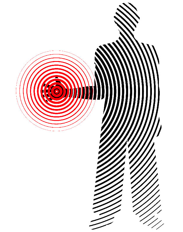 Vers un nouvel outil d��valuation des dyskin�sies&nbsp;?