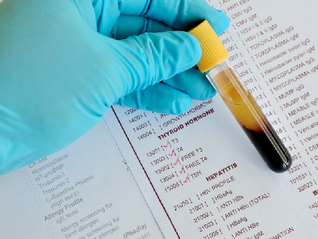 Hypothyro�die infraclinique&nbsp;: recommandations de la Soci�t� am�ricaine de m�decine de la reproduction