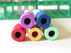 Dosage plasmatique du VEGF&nbsp;: vers un nouveau biomarqueur de thrombose chez les patients canc�reux&nbsp;?