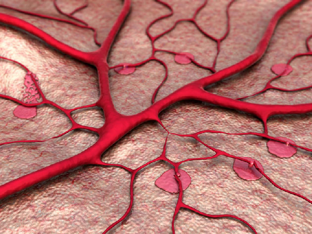 Efficacit du CCX168, un inhibiteur du rcepteur C5A, dans les vascularites ANCA : rsultats de ltude CLEAR, essai randomis de phase 2