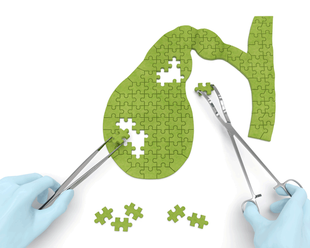 Prise en charge des polypes de l'endom�tre de d�couverte inopin�e durant une FIV&nbsp;: une �tude cas contr�le