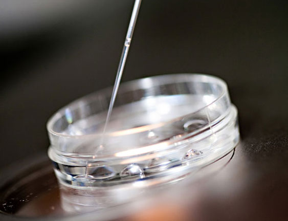 Les milieux de culture embryonnaire ont-ils un impact sur la sant� et le d�veloppement des enfants n�s apr�s f�condation in vitro&nbsp;?