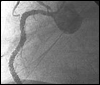 Angioplastie percutan�e coronaire (APC) dans les coronaropathies stables&nbsp;: traitement m�dical optimal associ� ou non&nbsp;?