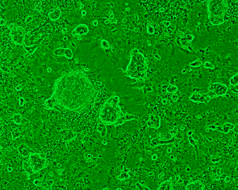 La culture des cellules souches spermatogoniales humaines pour la th�rapie cellulaire&nbsp;: o� en est-on&nbsp;?