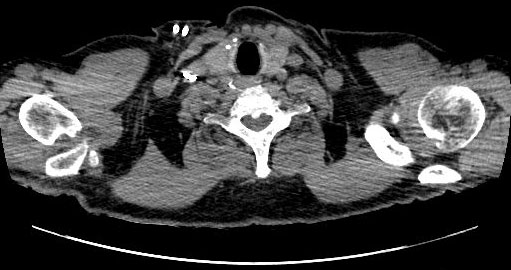 Une dorsalgie suraig�e