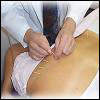 L�ad�nosine, m�diateur de l�acupuncture