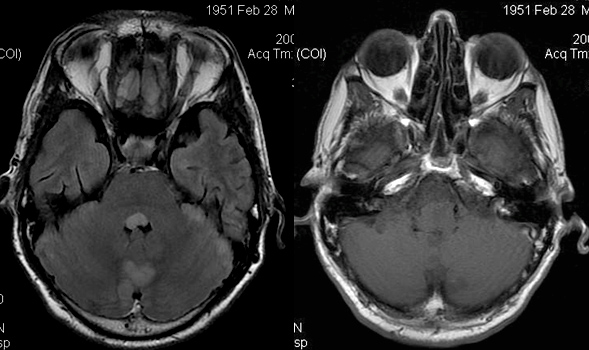 Les envahisseurs de l�espace m�ning�