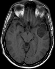 Le CD qui signe le diagnostic