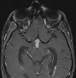 Difficile d'en croire ses yeux