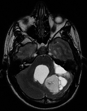 Les cheveux dans la t�te