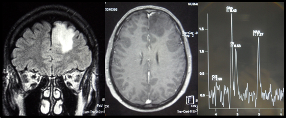 Un train peut en cacher un autre, pas par hasard