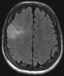 Trois ou quatre&nbsp;?