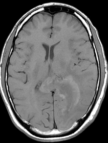 Un d�faut de maturit� ou de maturation&nbsp;?