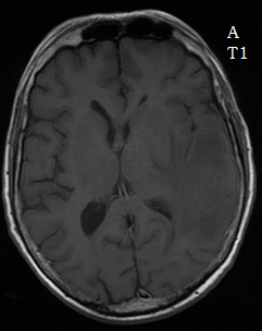 En IRM, comme la nuit, tous les chats sont gris