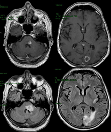 Un virus de la prolifration