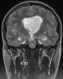 Des bulles de savon dans la t�te