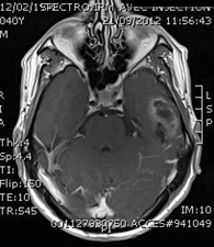 Une association malheureuse