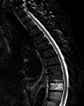 La r�cidive tr�s � distance