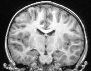 Le fenouil b�tard&nbsp;!