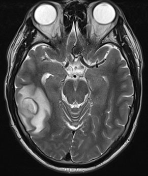 Quel est votre diagnostic&nbsp;?