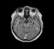 Dommage collat�ral