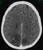 Une urgence qui presse