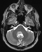 Une histoire (Hi)Stone