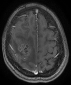 Une localisation trompeuse