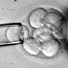 Un �piderme reconstitu� � partir de cellules souches