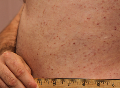 dossier, paroles d'experts, pex