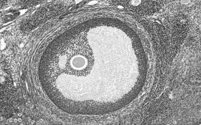 Progesterone-to-follicle index is better correlated with in vitro fertilization cycle outcome than blood progesterone level.