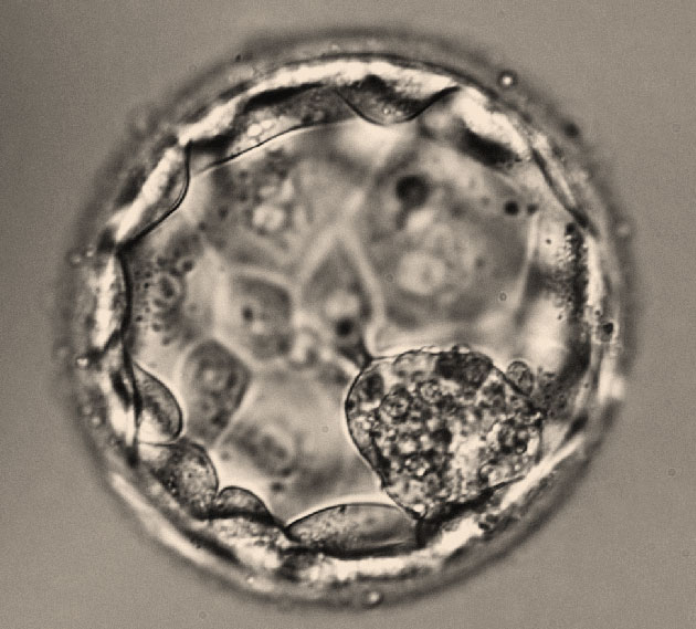 Les microARNs dans le milieu de culture des blastocystes sont d�riv�s des cellules du trophectoderme et peuvent �tre �tudi�s afin d��valuer la comp�tence de l�embryon humain � s�implanter