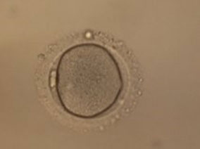 Caract�ristiques de la fonction de reproduction chez les femmes pr�sentant une Insuffisance Ovarienne Pr�matur�e (IOP)