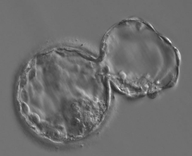 Evaluation morphocin�tique du d�veloppement embryonnaire dans un mod�le murin&nbsp;: corr�lation fonctionnelle et mol�culaire