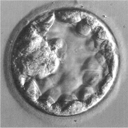 Auto-organisation de l'embryon humain en l'absence de tissu maternel