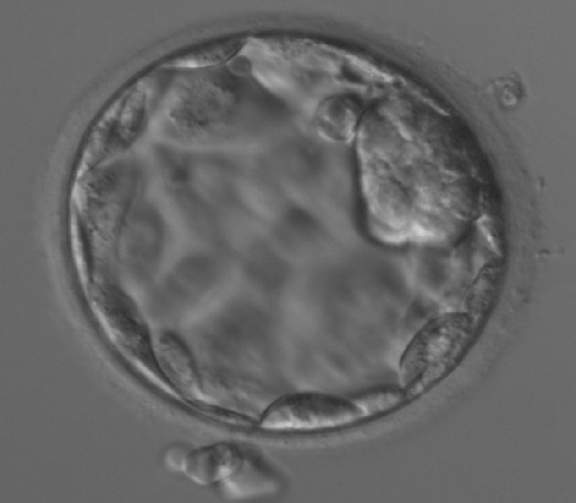Quels sont les b�n�fices et inconv�nients des transferts au stade de J2/J3 et au stade de blastocyte&nbsp;?