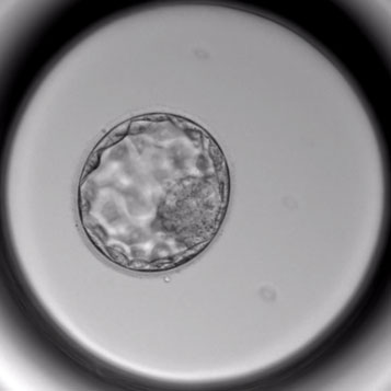 Mise au point d�un algorithme, applicable quelles que soient les conditions de culture, pr�disant l�implantation des embryons transf�r�s � J3 selon des crit�res de s�lection morpho-cin�tique