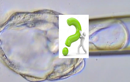 La fiabilit� du d�pistage pr�implantatoire des aneuplo�dies (DPI-A) est compromise par le mosa�cisme embryonnaire m�me au stade de blastocyste