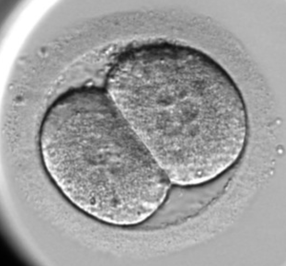 La multinucl�ation au stade deux cellules est un facteur pr�dictif ind�pendant des issues de grossesses en ICSI