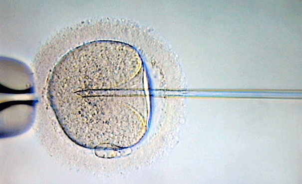 La dur�e d'abstinence sexuelle de l'homme avant la r�alisation de l'AMP affecte-t-elle le taux de naissance vivante&nbsp;? Etude r�trospective de 1030 cycles