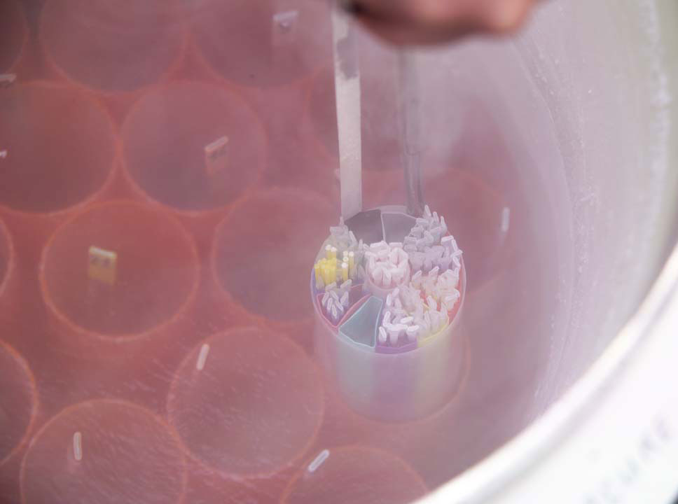 Quand congeler du sperme pour r�duire le risque d�azoospermie le jour de l�ICSI