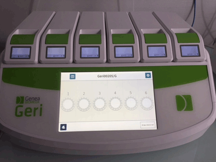 Le transfert mono-embryonnaire � J3 apr�s s�lection par time-lapse versus transfert � J5 apr�s s�lection morphologique&nbsp;: une �tude randomis�e de non-inf�riorit�