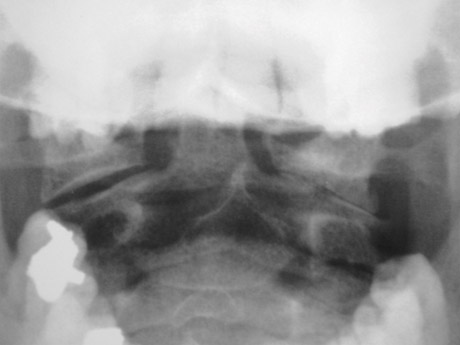 Un petit air pench�