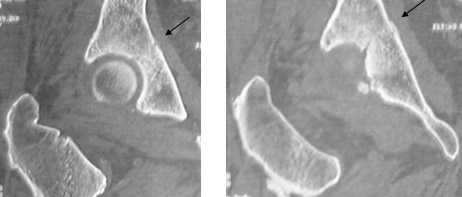 Attention aux �carts de conduite